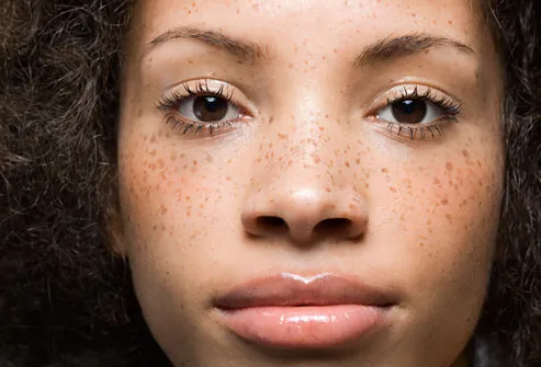 getty_rf_photo_of_girl_with_freckles.jpg