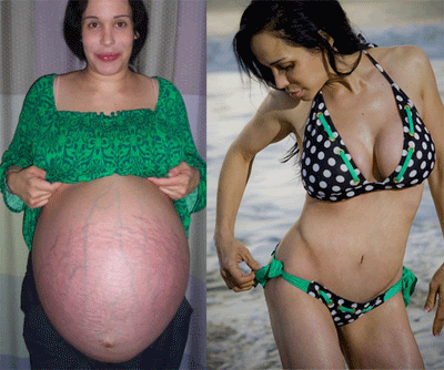 octomom-tummy-tuck.gif