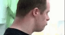 downs-down-syndrome.gif