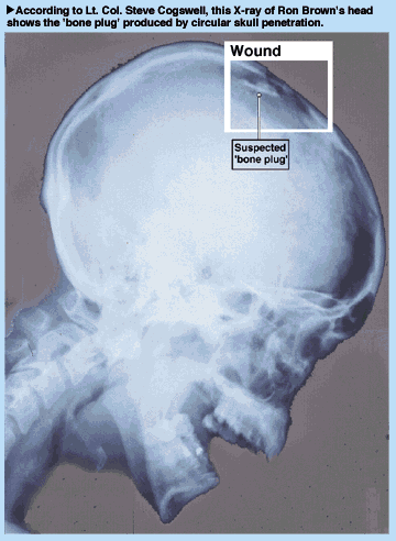 xray09.gif