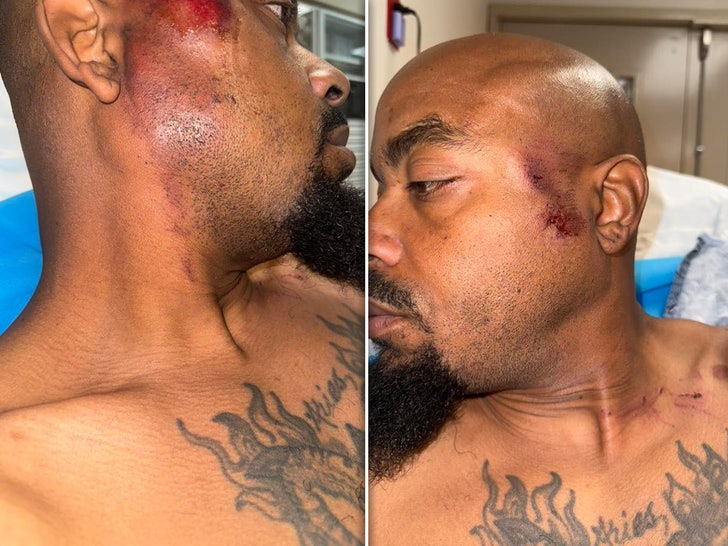 repo man injuries sub facebook