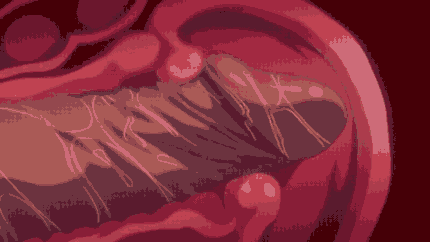 292F3CE.gif