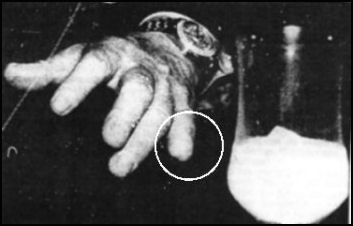 20090814-yakuza%20pinkie.jpg