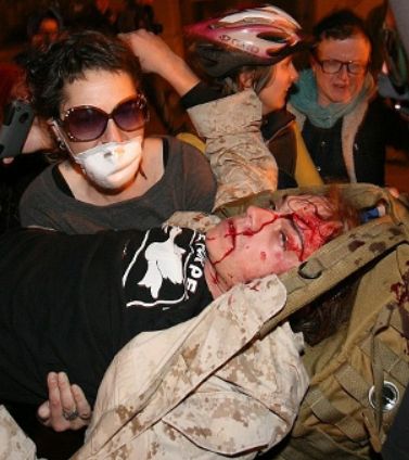 scott-olson-bleeding.jpg