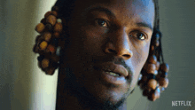injuries-happen-man-jimmy-butler.gif