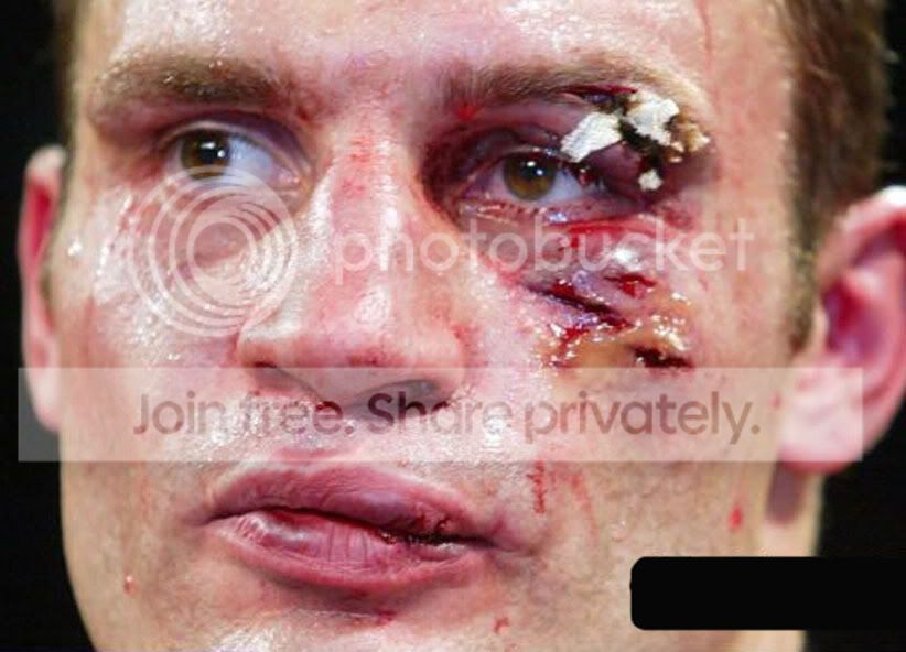 bloodyklit01.jpg