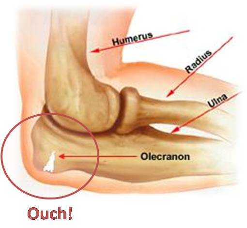 elbow_broken.jpg