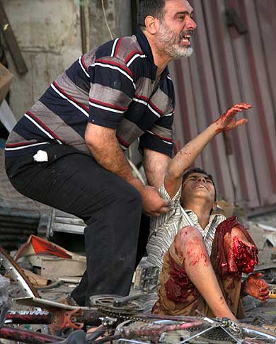 horribly_wounded_iraqi_child.jpg