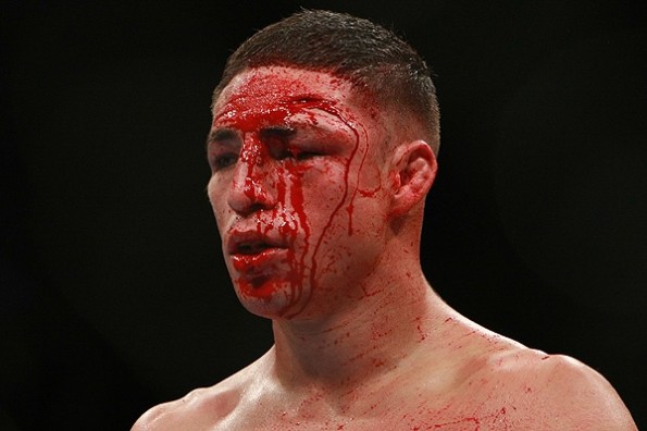 Diego-Sanchez-595x396.jpg