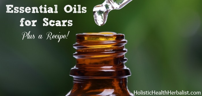 Essential-Oils-for-Scars.jpg