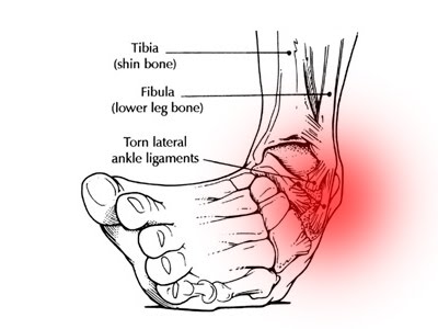 ankle-pic-21.jpg