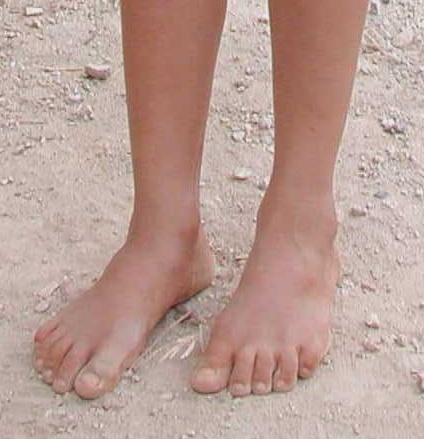 Bare_feet.JPG