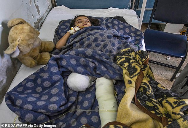 A girl whose leg was amputated after she was badly wounded in the shelling of Ras al-Ayn lies in hospital in Tal Tamr, nearby