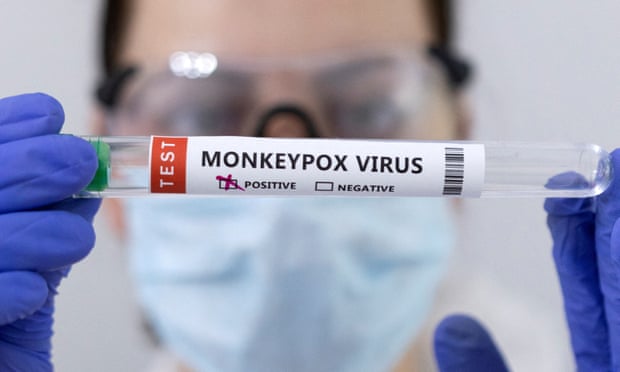 test tubes labelled Monkeypox virus positive