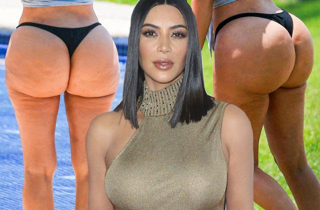 kim-kardashian-butt-implants-plastic-surgery-doctor-pp-.jpg